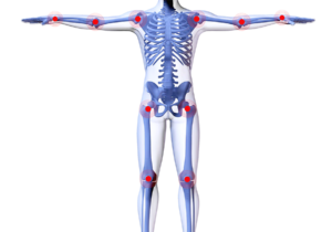 probiotique arthrose et douleurs articulaires